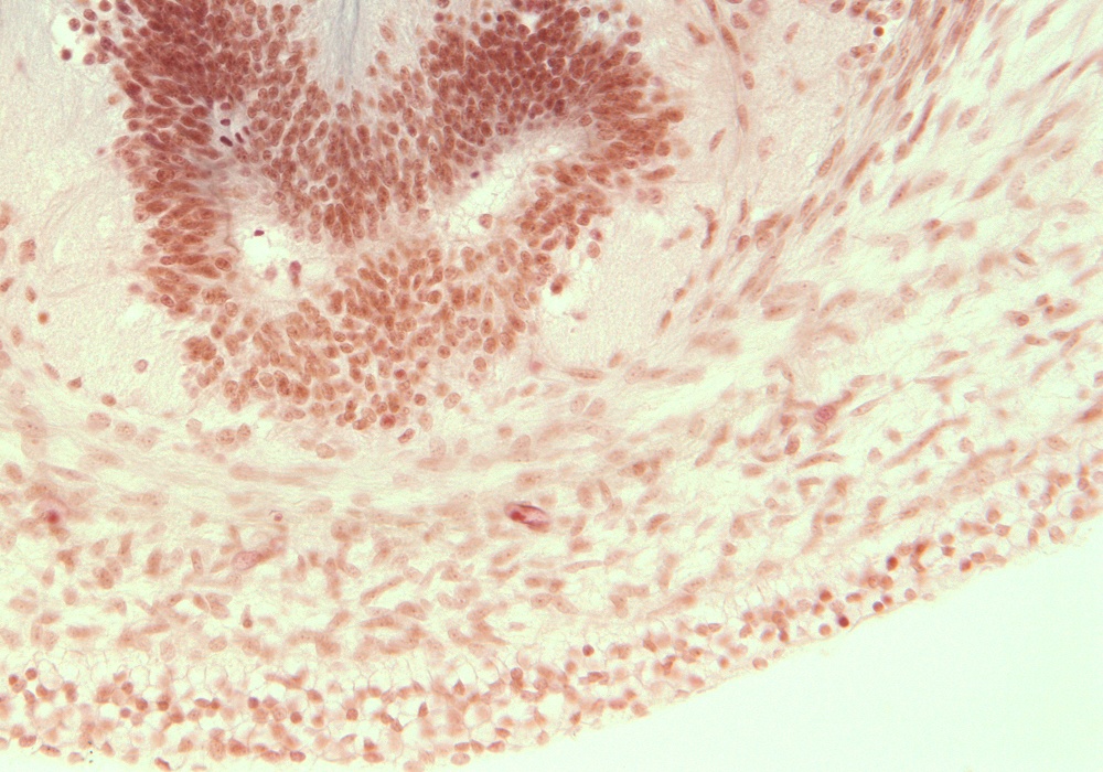 Caudal End of Spinal Cord