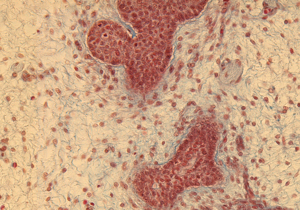 Parotid Gland