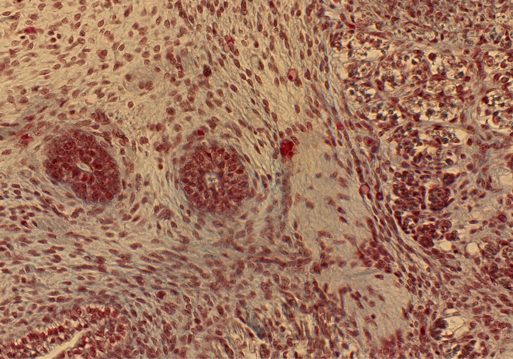 Sublingual Gland