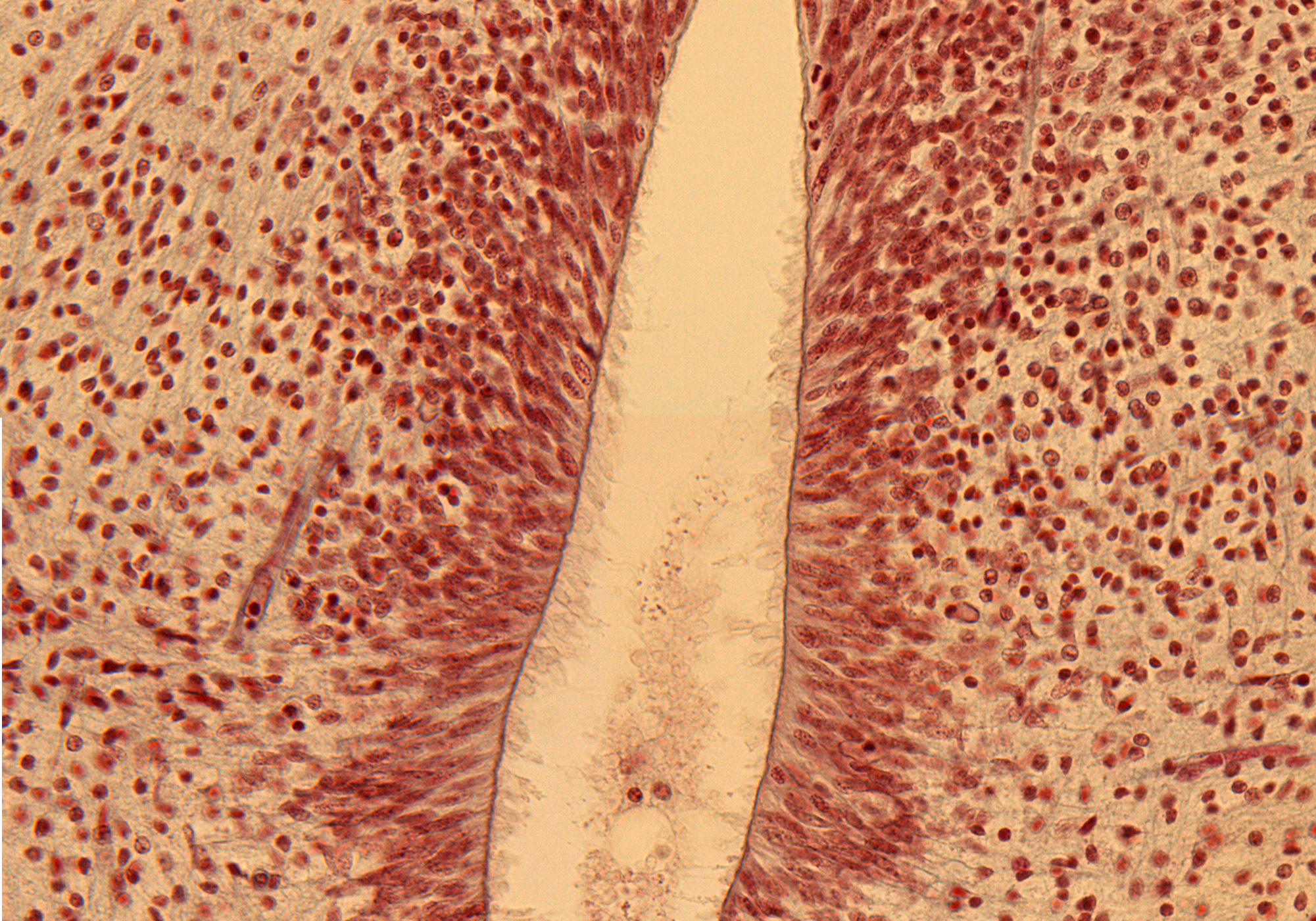 Ventricular Zone in Thoracic Region