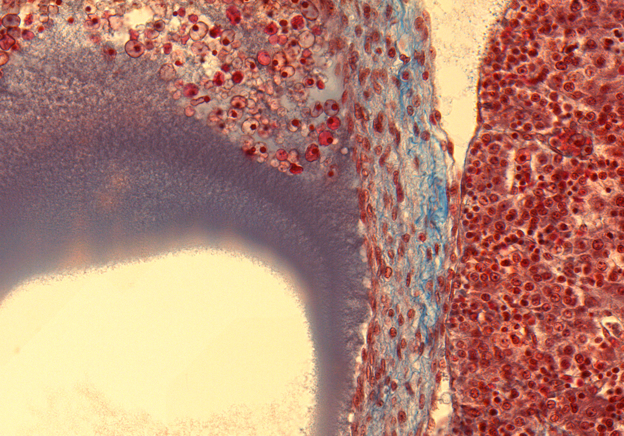 Ductus Venosus Wall