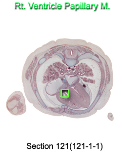 Rt. Ventricle Papillary M.