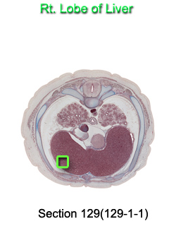 Rt. Lobe of Liver