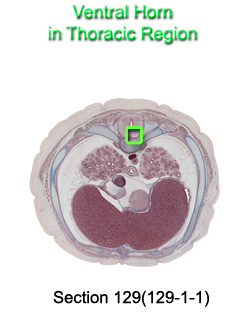 Ventral Horn in Thoracic Region