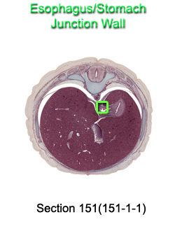 Esophagus/Stomach Junction Wall