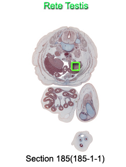 Rete Testis