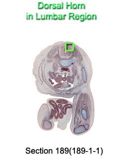 Dorsal Horn in Lumbar Region