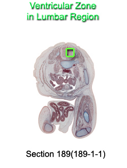 Ventricular Zone in Lumbar Region