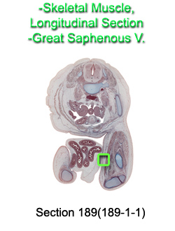 Skeletal Muscle Logitudinal Section, Great Saphenous V.