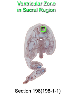 Ventricular Zone in Sacral Region