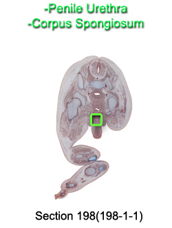 Penile Urethra and Corpus Spongiosum