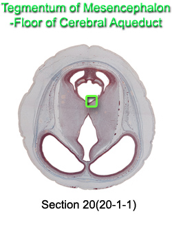 Tegmentum of Mesencephalon - Floor of Cerebral Aqueduct