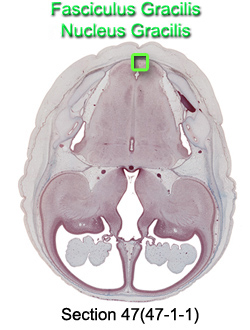 Fasciculus Gracilis and Nucleus Gracilis