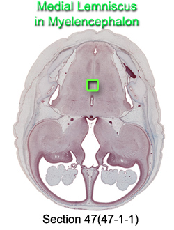 Medial Lemniscus in Myelencephalon