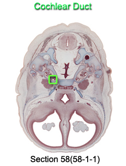 Cochlear Duct