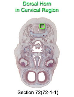 Dorsal Horn in Cervical Region