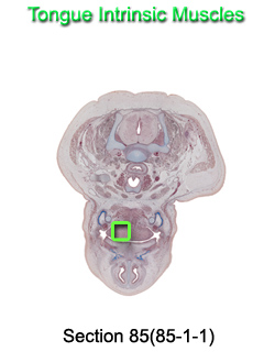 Tongue Intrinsic Muscles