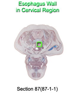 Esophagus Wall in Cervical Region