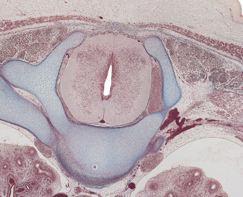 T-4 Spinal Cord and Vertebra