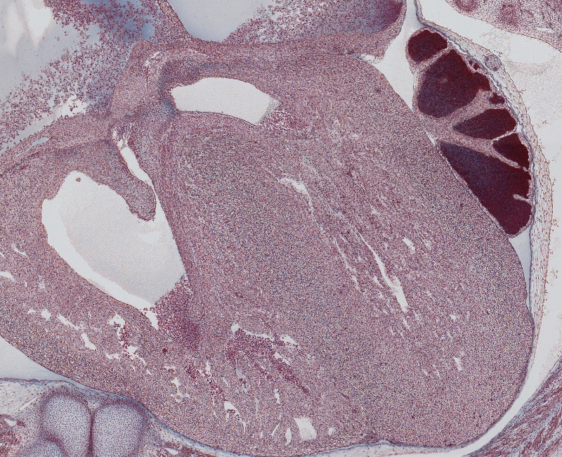 Heart, Lt. and Rt. Ventricles Inverventricular Septum