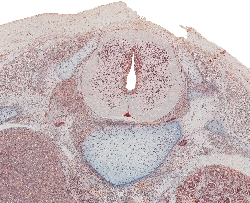 Spinal Cord and Vertebra at T-12