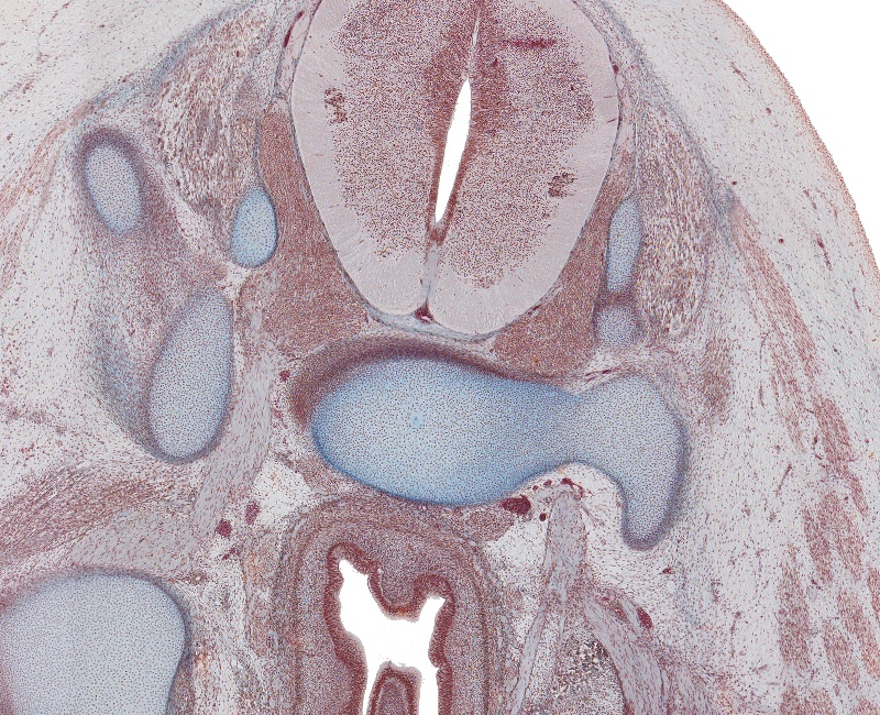 S-2 Spinal Cord, Rectum and Sacral Plexus