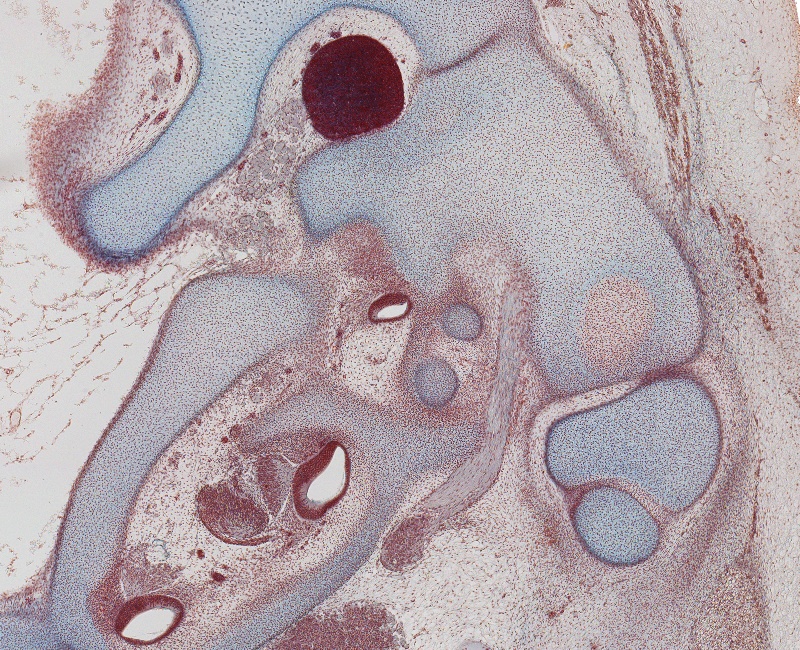 Cochlea, Stapes, CN VII, and Geniculate Ganglion