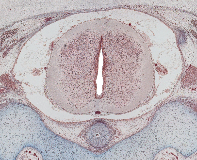 Spinal Cord at C-1