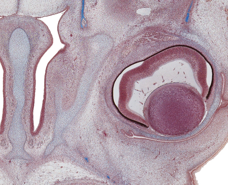 Nasal Cavity and Mid. Eyeball