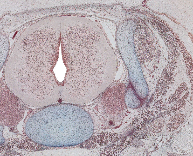 C-4 Spinal Cord