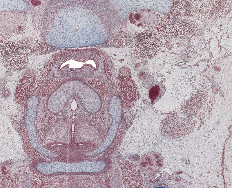 Larynx and Sup. Parathyroid Gland