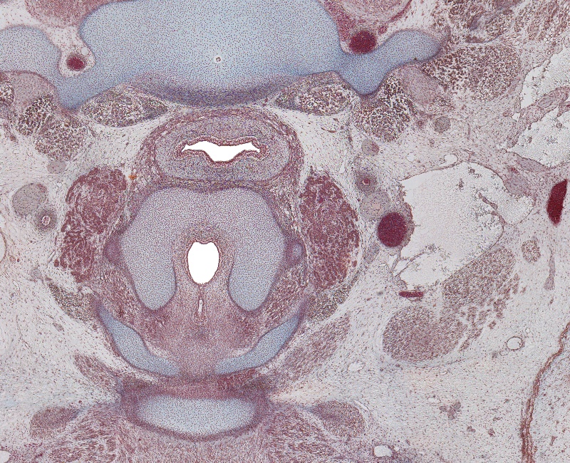 Larynx and Inf. Parathyroid Gland