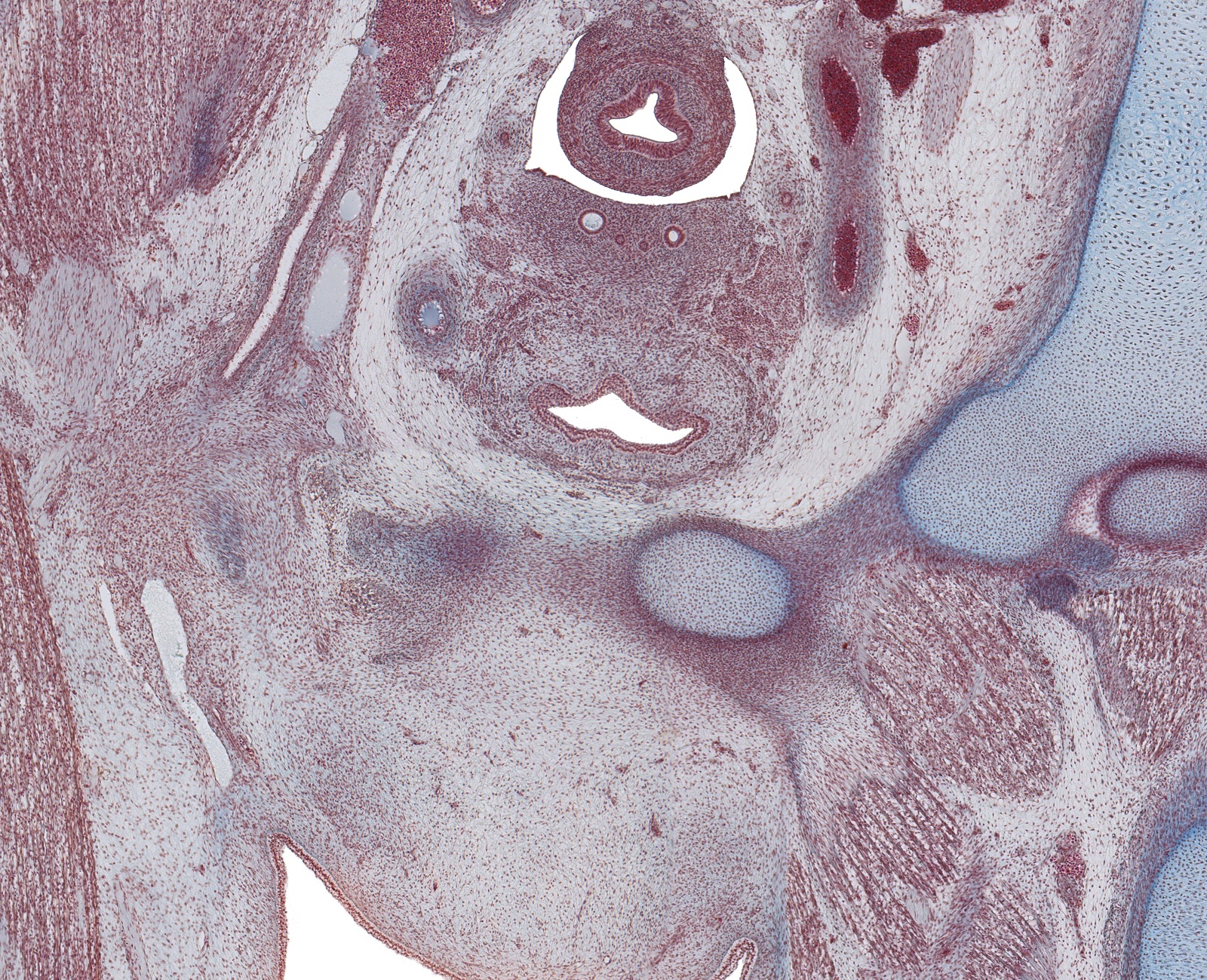 Paramesenephric Ducts, and Gubernaculum Testis in Scrotal Fold