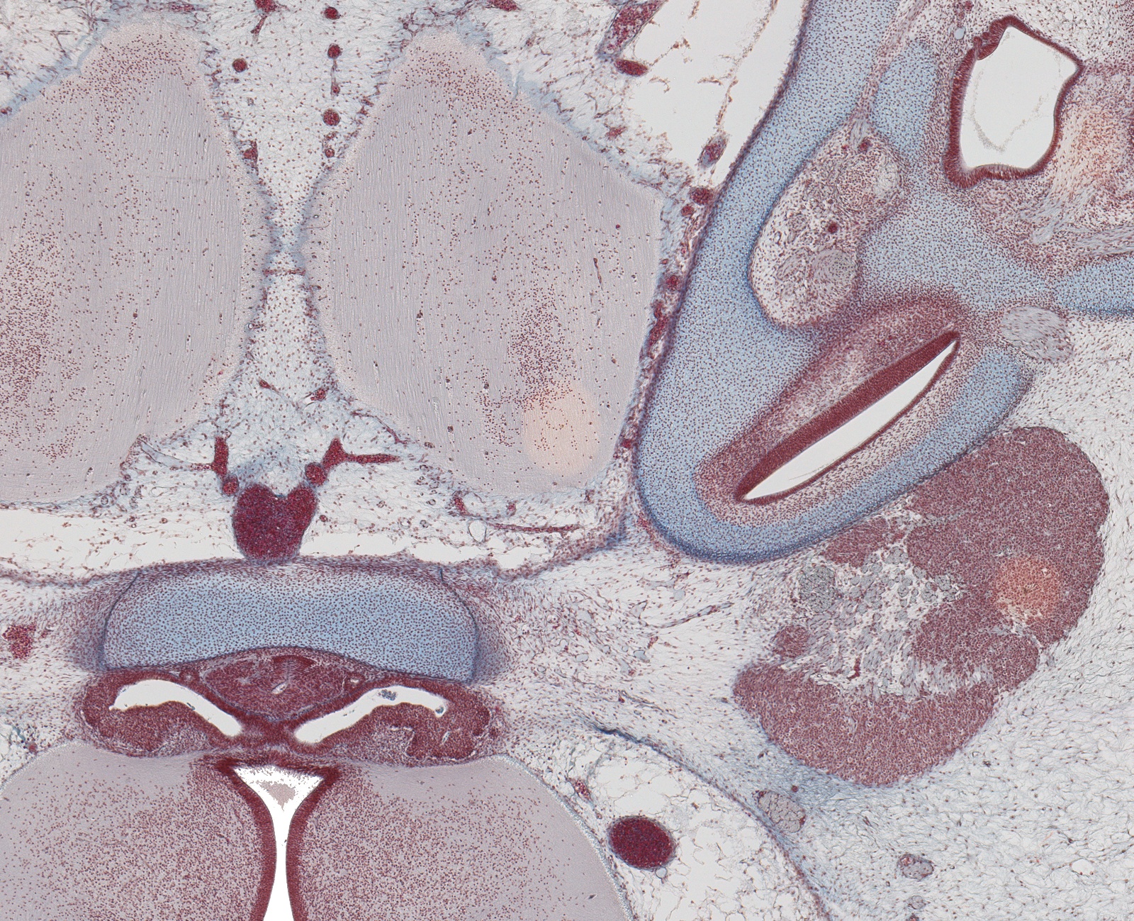 Neurohypophysis and Edge of Pons