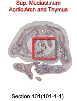 Sup. Mediastinum Aortic Arch and Thymus