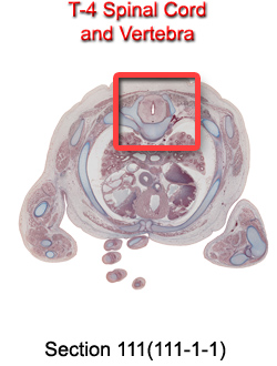 T-4 Spinal Cord and Vertebra