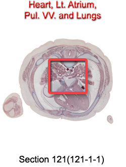 Heart, Lt. Atrium, Pul. VV. and Lungs