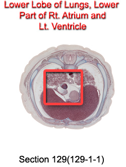 Lower Lobe of Lungs, Lower Part of Rt. Atrium and Lt. Ventricle