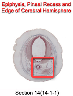 Epiphysis, Pineal Recess, and Edge of Cerebral Hemisphere