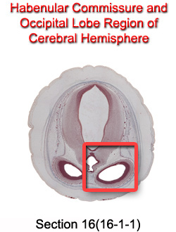 Habenular Commissure and Occipital Lobe Region of Cerebral Hemisphere