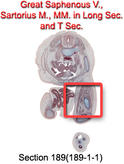 Great SaphenousV., Sartorius M., MM. in Long Sec. and T Sec.