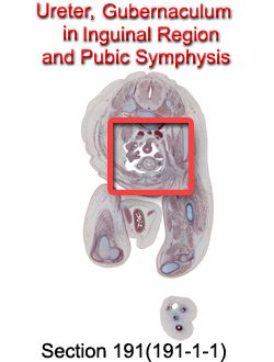 Ureter, Gubernaculum in Inguinal Region and Pubic Symphysis