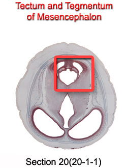 Tectum and Tegmentum of Mesencephalon