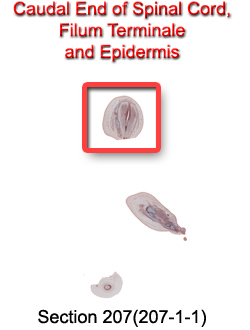 Caudal End of Spinal Cord, Filum Terminale, and Epidermis