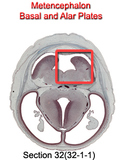 Metencephalon Basal and Alar Plates