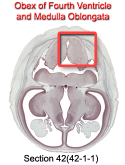 Obex of the Fourth Ventricle and Medulla Oblongata