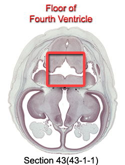 Floor of Fourth Ventricle