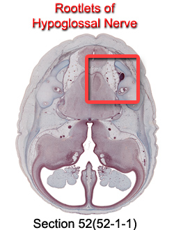 Rootlets of Hypoglossal Nerve