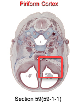 Piriform Cortex