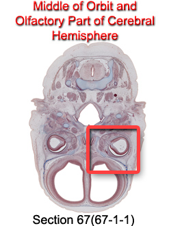 Middle of Orbit and Olfactory Part of Cerebral Hemisphere